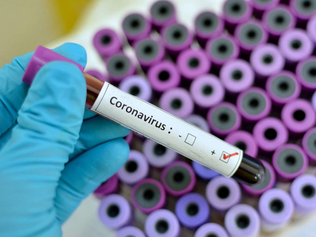More 16 tested positive for coronavirus in Vadodara Vadodara ma corona na vadhu 16 case positive nodhaya 4 patrakar pan samel